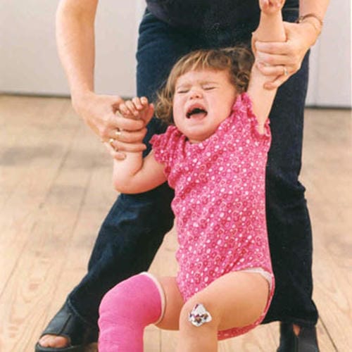 A toddler in pink rompers wails loudly while being held upright by an adult. One of her legs is wrapped in a pink cast with a band-aid on the knee; she cries in pain due to a leg injury.